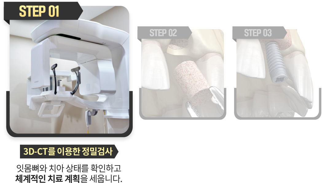 3D-CT를-이용한-정밀검사