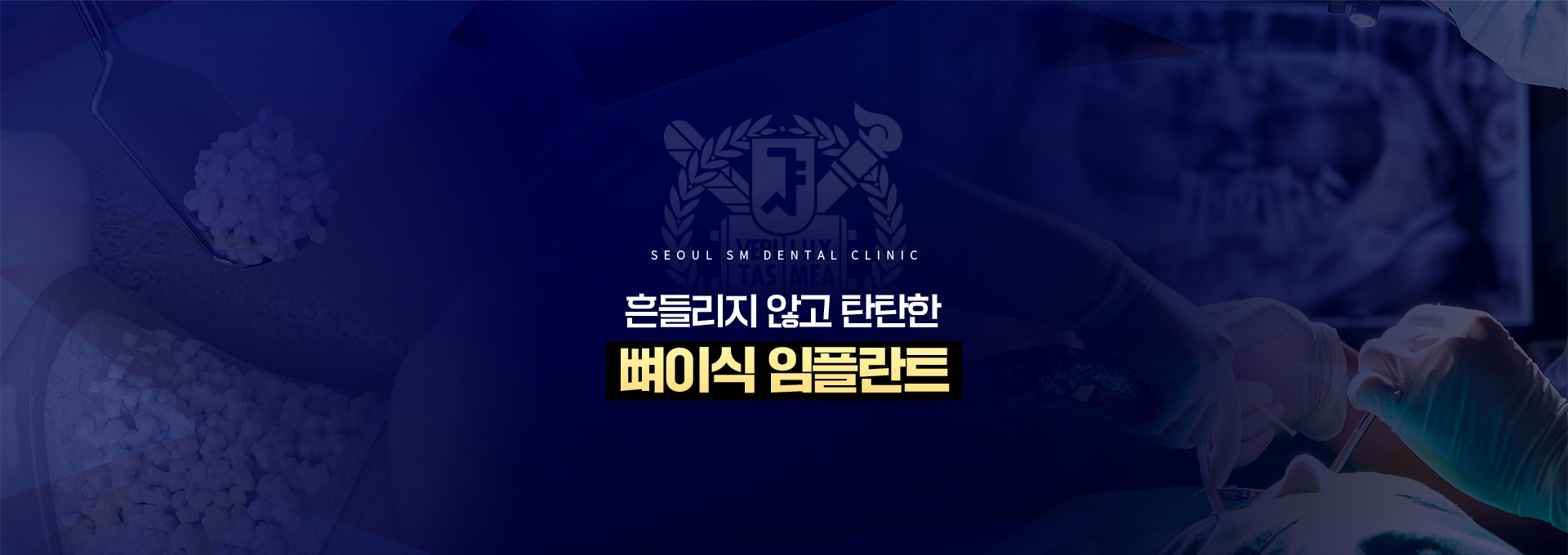 흔들리지-않고-탄탄한-뼈이식임플란트