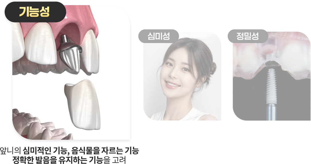 기능성-앞니의-심미적인-기능-음식물을-자르는-기능-정확한-발음을-유지하는-기능을-고려