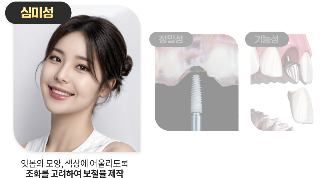 심미성-잇몸의-모양-색상에-어울리도록-조화를-고려하여-보철물-제작