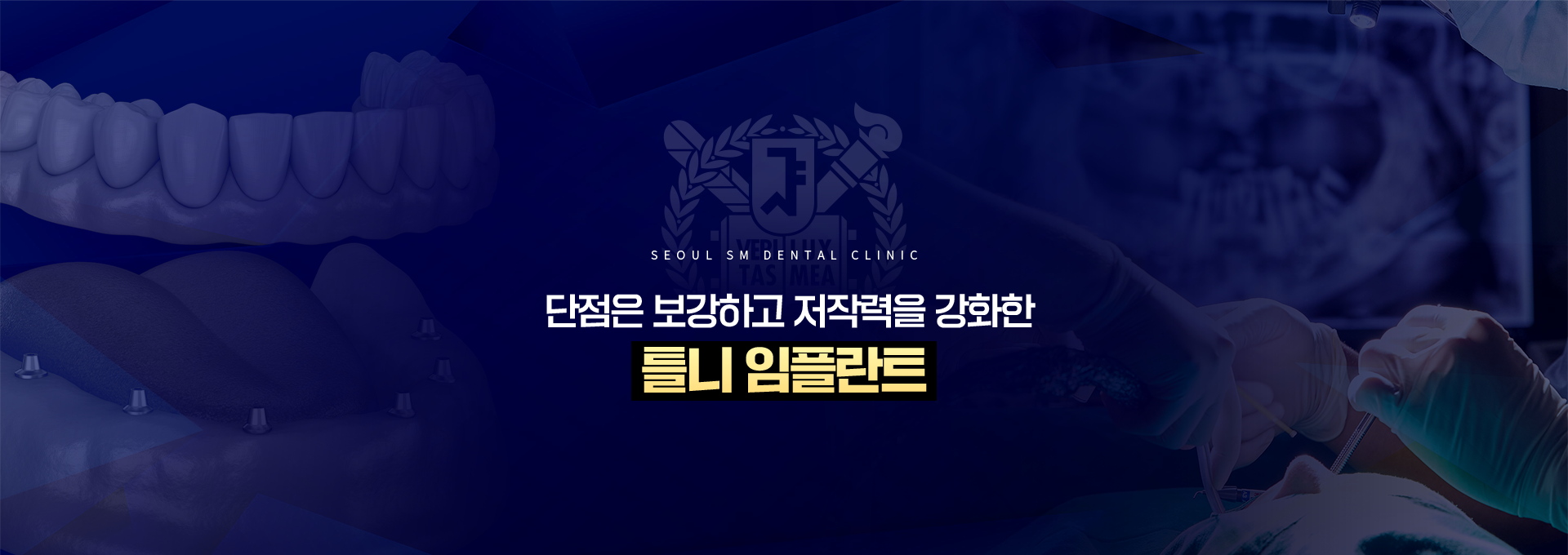 단점은-보강하고-저작력을-강화한-틀니임플란트
