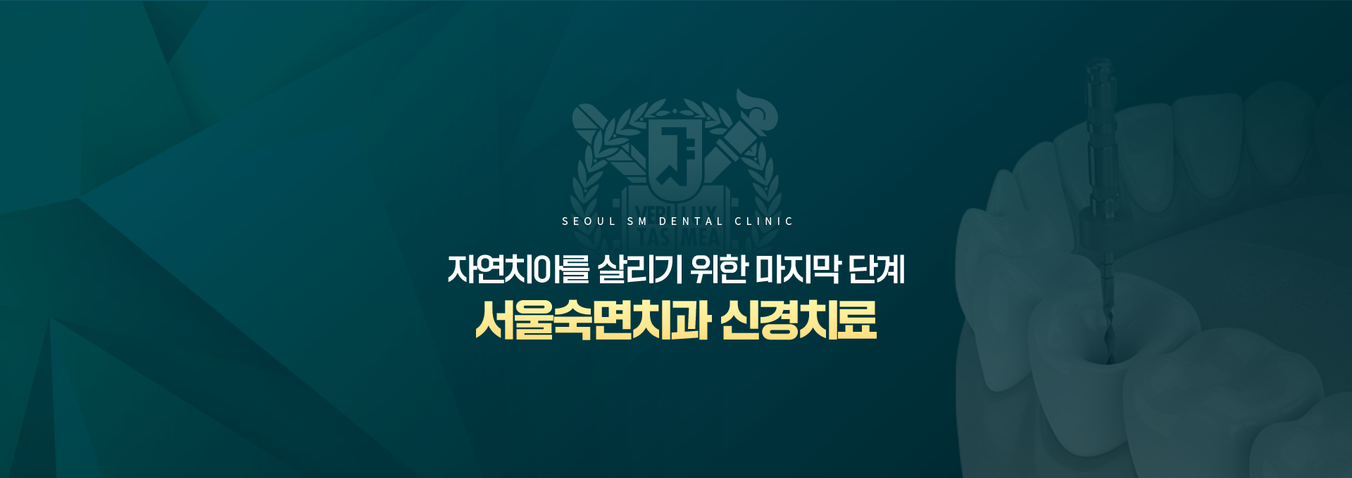 자연치아를-살리기-위한-마지막-단계-서울숙면치과-신경치료