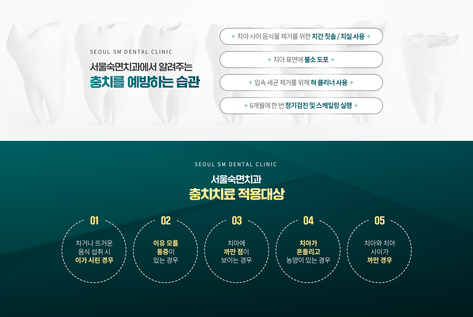 충치를-예방하는-네가지-습관-충치치료-적용-대상-숙면치과치료-주의사항