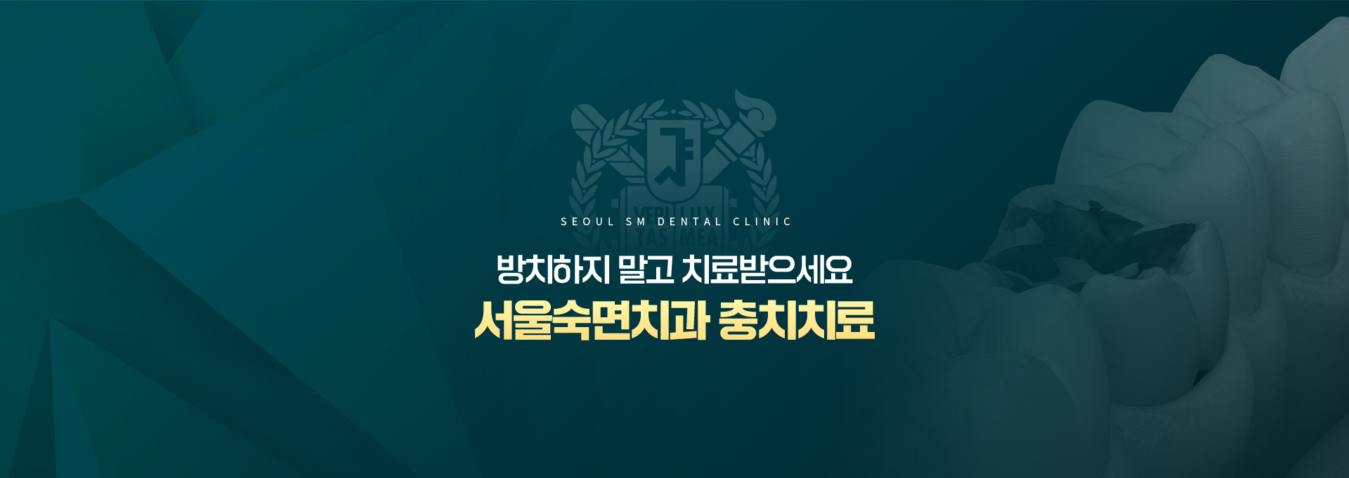 방치하지-말고-치료받으세요-서울숙면치과-충치치료