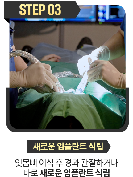 새로운-임플란트-식립