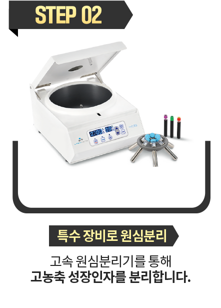 특수-장비로-원심분리