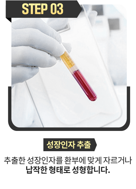 성장인자-추출