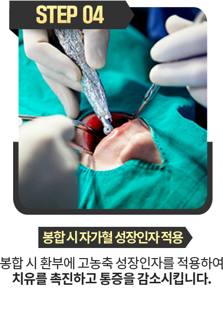 봉합-시-자가혈-성장인자-적용