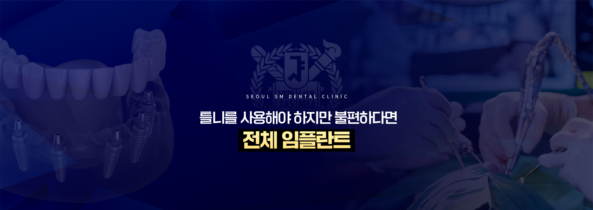 틀니를-사용해야-하지만-불편하다면-전체임플란트