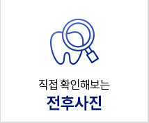 전후사진