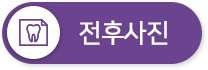 전후사진